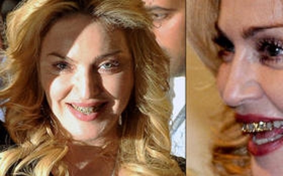 Madonna megint kicsapta az összes biztosítékot