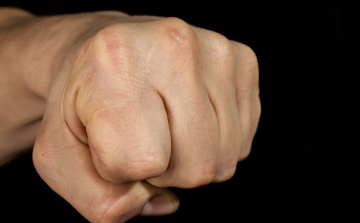 Nem elég, hogy nekiütközött, még meg is ütötte